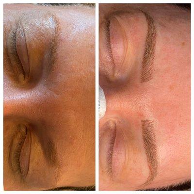 Microblading