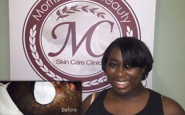 Real Customers - Real Results using Morris Code Beauty® Advanced Aesthetics Skin Care Products & Services!