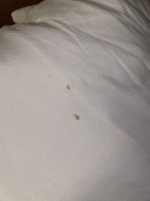 THERE IS BLOOD ON ONE OF THE PILLOWS IN THE ROOM. Disgusting!!!! Cannot believe this right now.