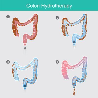 Colon Hydrotherapy