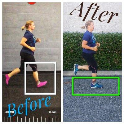 From an impacting heel strike to a forefoot contact = less injury, long time running!