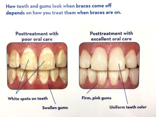 We offer orthodontic treatment here with our specialist who has experience over 25 years!! Thumbs up