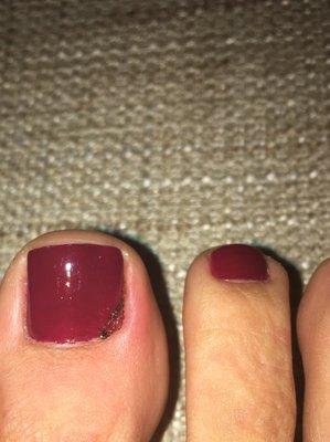 Dried blood and inflamed skin from when my pedicurist cut my skin instead of the cuticle yesterday. Good job on the polish though.