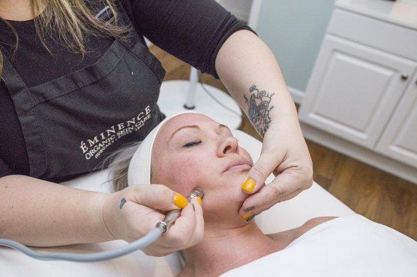 Diamond Tip Microdermabrasion