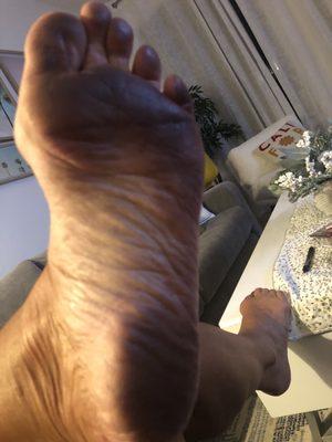 Black feet from standing on their towel