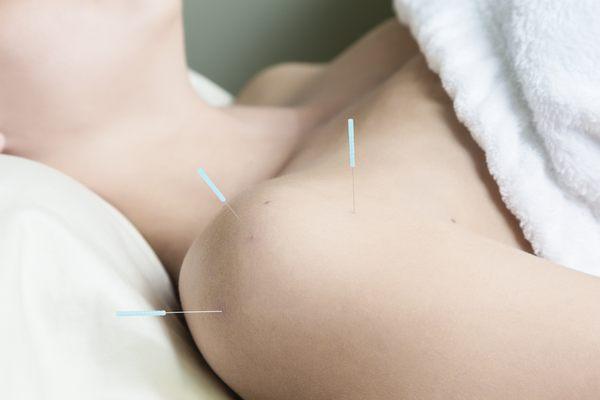 Chinese Acupuncture
 Acupuncture
 Chinese Medicine
 Pain Management
 Stress Relief
 Anxiety Relief