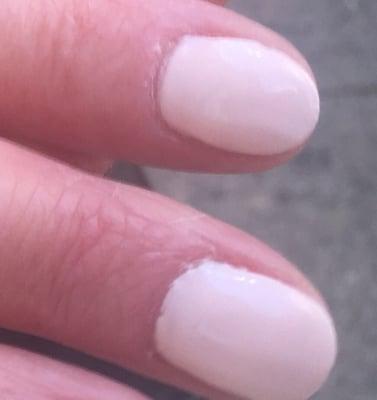 I know a close up nail photo is gross, but so u can see for yourself what I mean.