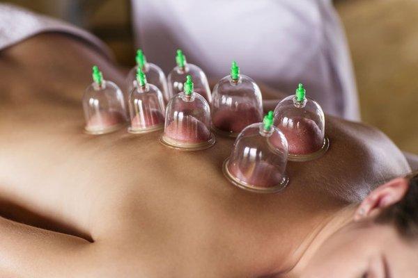 Cupping Massage