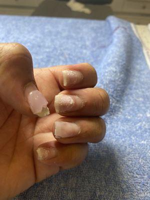 Hack job of how they remove acrylic nails (with tips)