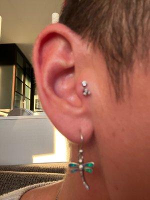 Double tragus!