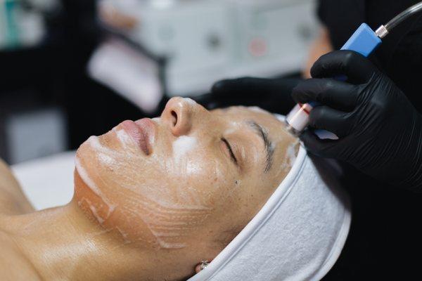 Wet/Dry Microdermabrasion Treatment