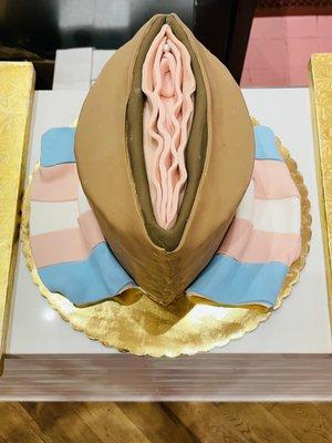 Trans vagina