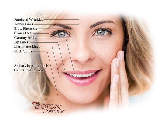 Botox Injectable Relaxer