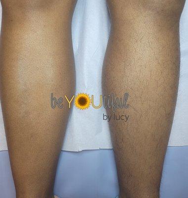 Full leg waxing . Before and After