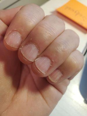 Worst manicure.