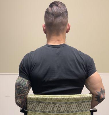 Day 8 after-cut growth (back) (Joe Roslie)