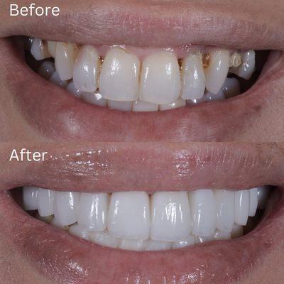 Restore Dental