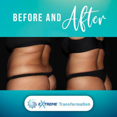 Extreme Transformation Program - Before and After