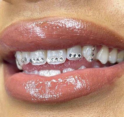 Teeth Gem application