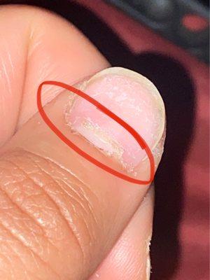 cut cuticle under acrylic nail