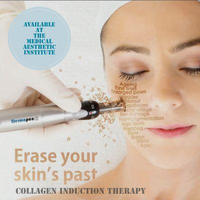 Stem Cell therapy included with every Microneedling session