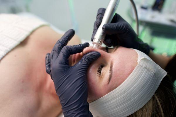 Hydro - dermabrasion Facial