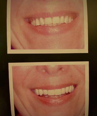 Dr Dzitzer can help you create your desired smile