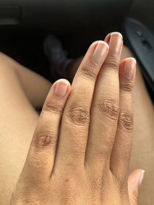 Uneven french lines (pinky and ring finger for reference)