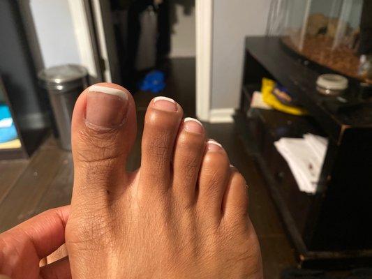 big toe is not square like i asked and looks thick and ugly