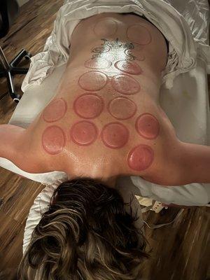 Cupping