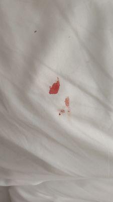 Bloody sheets from nighttime biting frenzy.