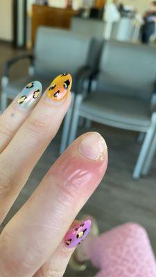 Nail infection after visiting color me true nail salon