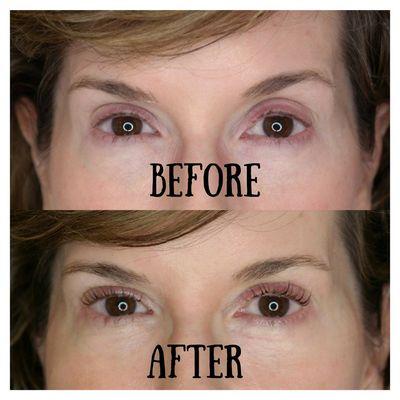 LASH LIFT TRANSFORMATION