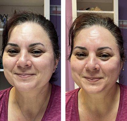 This beauty loved the results of her very first Custom Facial w/an enzyme and microderm added. The lymphatic drainage did wonders for her!