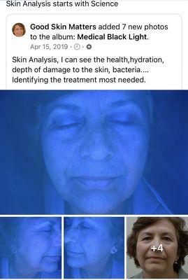 GSM Beauty Skin Analysis