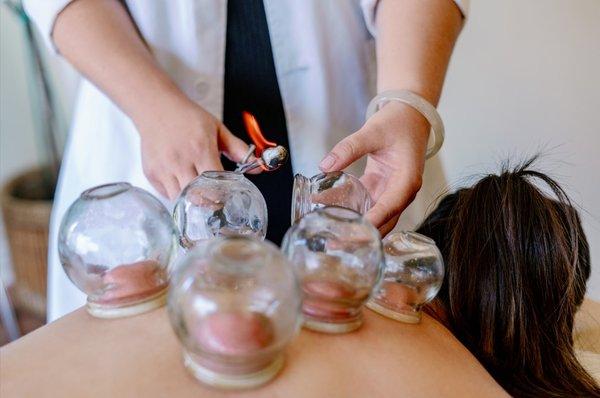 Fire Cupping available with Dr. Bree Simon, DACM, L.Ac