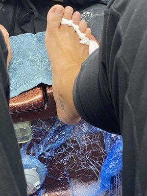 Using tissues to "separate" toes