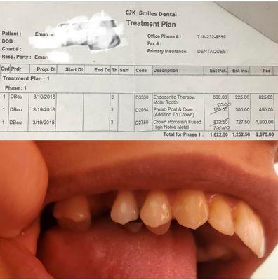 I lost a molar tooth#3 because of this negligent dentist. She’s sneaky, unprofessional, and does not know anything about dentistry.