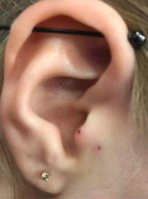 Shows the holes where the piercing was placed incorrectly.