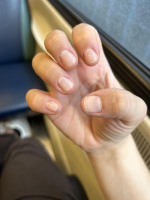 Short but healthier nails