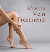 State of the art spider and varicose vein treatments