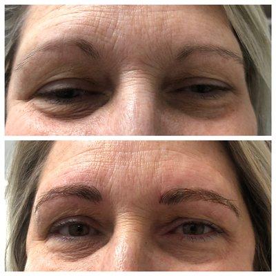 Before and After Microblading