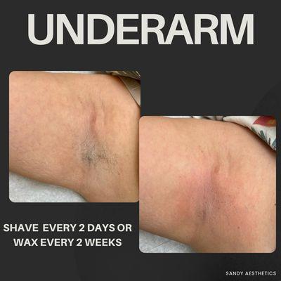 Underarm wax