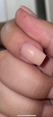 Cuticle is bad