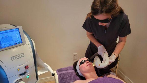 IPL photofacial