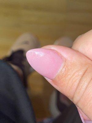 Shape and nail crack