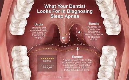 Sleep Apnea services in Claremont. We are here for your Sleep Apnea needs.