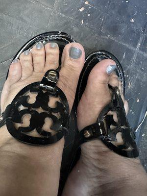 Horrible pedicure