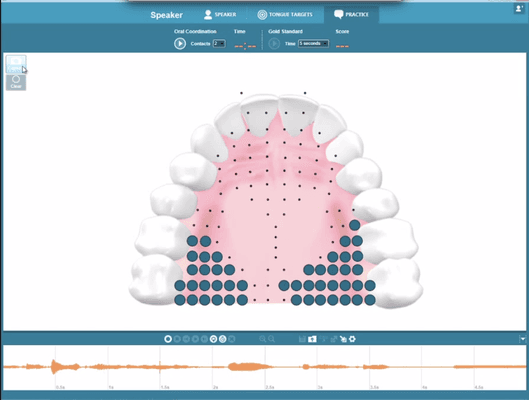 SmartPalate Software