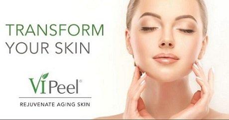 Chemical Peel